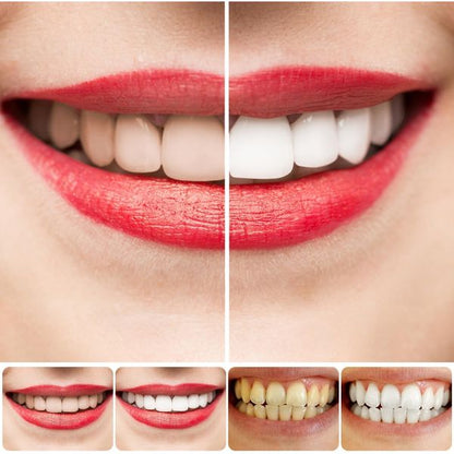 DentWhite™ – Pâte Dentifrice Blanchissante